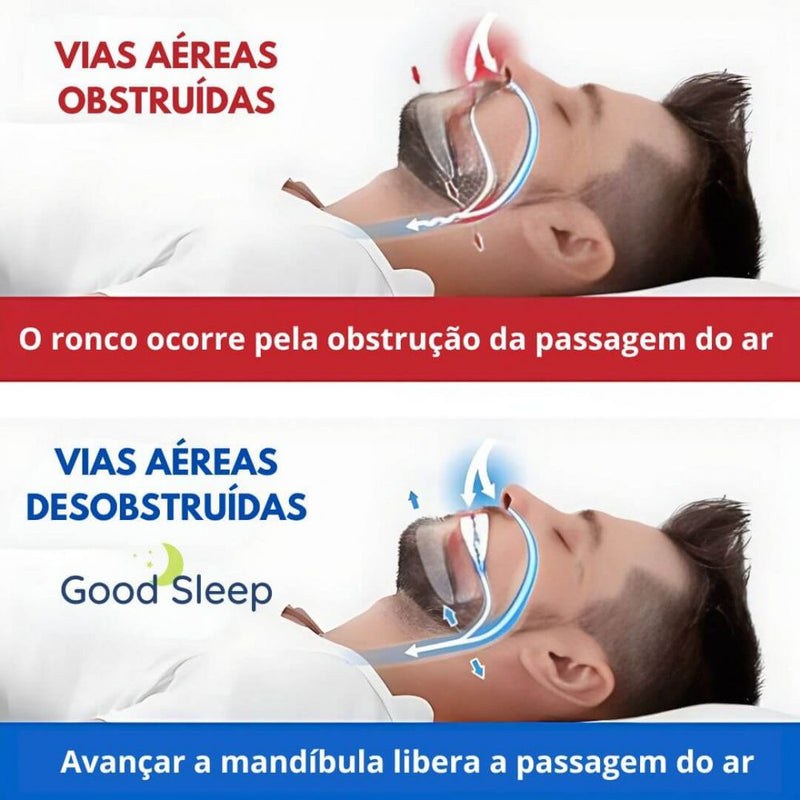 Aparelho Anti Ronco e Anti Bruxismo Ajustável e Moldável - Good Sleep®